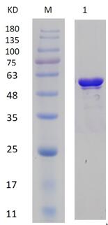 12% SDS-PAGE analysis profiles of purified PA0041-29-514 (CBB stained).